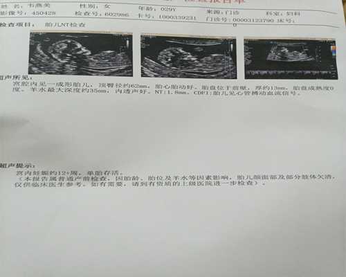 昆明代孕产子要多少费用,北京供卵医院做三代试管婴儿移植大概需要多少钱_上