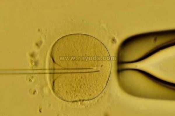 昆明试管代生机构,试管婴儿取卵后肚子不舒服是什么原因,反复取卵对卵巢有影