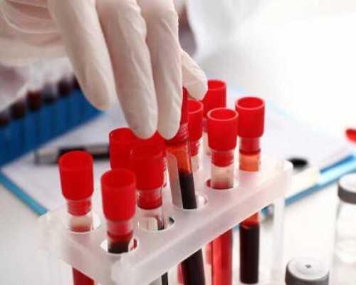 昆明哪里代孕合法,泰国试管婴儿移植后可以吃辣吗？-试管婴儿在医院建档能保